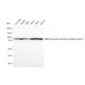 KD-Validated EEF2 Rabbit mAb (20 μl)