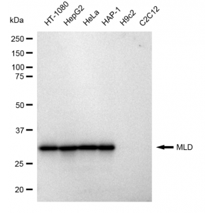 KD-Validated MLD Rabbit mAb (20 μl)