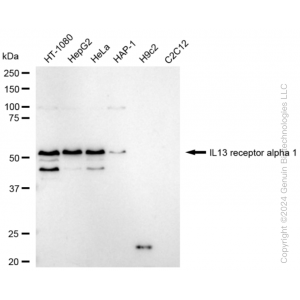 KD-Validated IL13RA1 Rabbit mAb (20 μl)