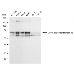 KD-Validated CDK16 Rabbit mAb (20 μl)