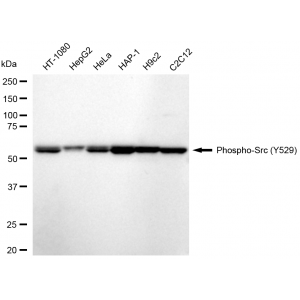 KD-Validated Phospho-Src (Y529) Rabbit mAb (20 μl)