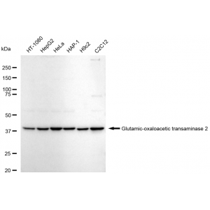 KD-Validated GOT2 Rabbit mAb (20 μl)