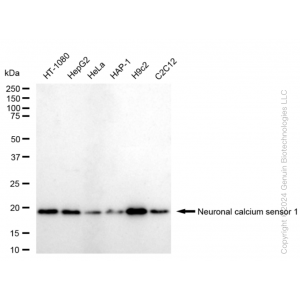 KD-Validated NCS1 Rabbit mAb (20 μl)