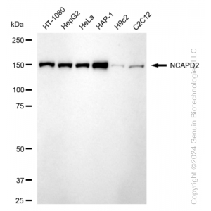 KD-Validated NCAPD2 Rabbit mAb (20 μl)