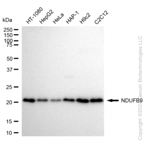 KD-Validated NDUFB9 Rabbit mAb (20 μl)