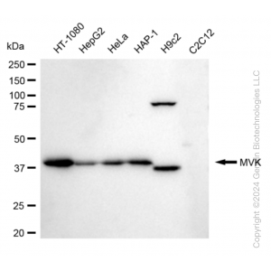 KD-Validated MVK Rabbit mAb (20 μl)