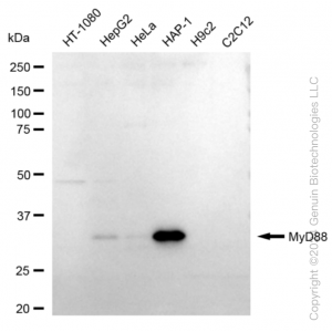 KD-Validated MYD88 Rabbit mAb (20 μl)