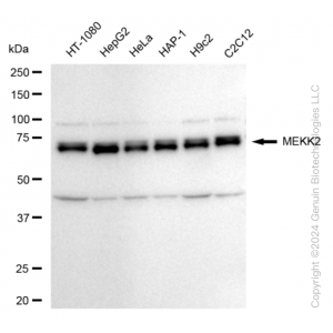 KD-Validated MAP3K2 Rabbit mAb (20 μl)