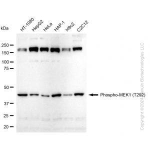 KD-Validated Phospho-MEK1 (T292) Rabbit mAb (20 μl)