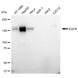 KD-Validated EGFR Rabbit mAb (20 μl)