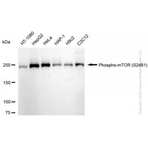 KD-Validated Phospho-mTOR (S2481) Rabbit mAb (20 μl)