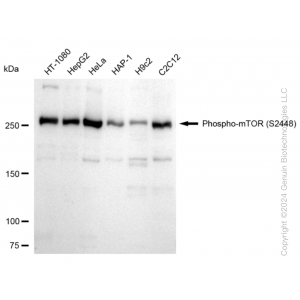 KD-Validated Phospho-mTOR (S2448) Rabbit mAb (20 μl)