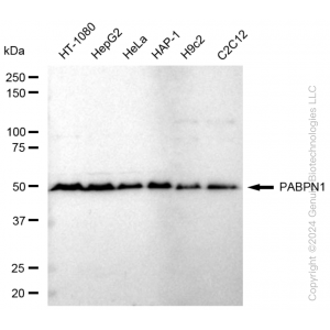 KD-Validated PABPN1 Rabbit mAb (20 μl)