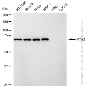 KD-Validated MTA2 Rabbit mAb (20 μl)