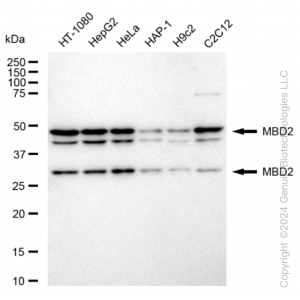 KD-Validated MBD2 Rabbit mAb (20 μl)