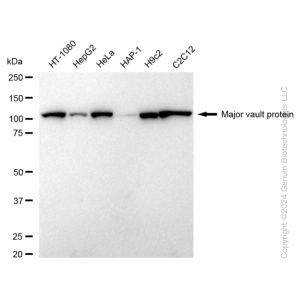 KD-Validated MVP Rabbit mAb (20 μl)