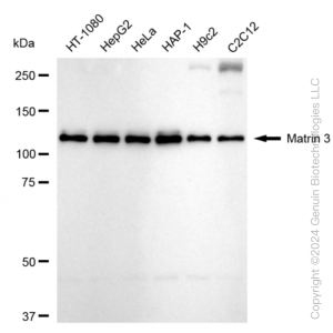 KD-Validated MATR3 Rabbit mAb (20 μl)