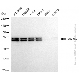KD-Validated MARK2 Rabbit mAb (20 μl)