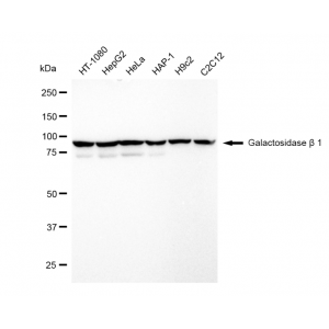 KD-Validated GLB1 Rabbit mAb (20 μl)