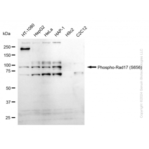 KD-Validated Phospho-Rad17 (S656) Rabbit mAb (20 μl)