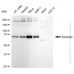 KD-Validated RAVER2 Rabbit mAb (20 μl)