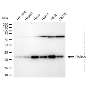 KD-Validated RAB4A Rabbit mAb (20 μl)