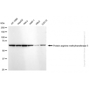 KD-Validated PRMT5 Rabbit mAb (20 μl)
