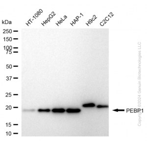 KD-Validated PBP Rabbit mAb (20 μl)