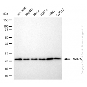 KD-Validated RAB7 Rabbit mAb (20 μl)