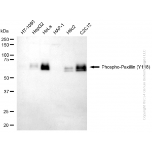 KD-Validated Phospho-PXN (Y118) Rabbit mAb (20 μl)