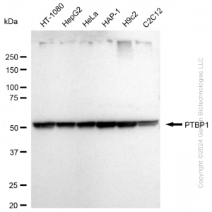 KD-Validated PTBP1 Rabbit mAb (20 μl)