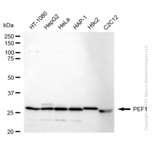KD-Validated PEF1 Rabbit mAb (20 μl)