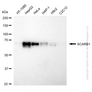 KD-Validated SCARB1 Rabbit mAb (20 μl)