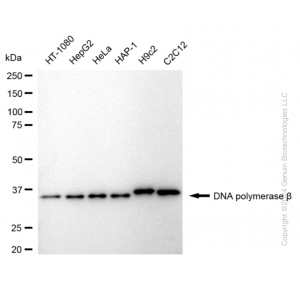 KD-Validated POLB Rabbit mAb (20 μl)