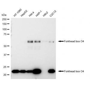 KD-Validated FOXO4 Rabbit mAb (20 μl)