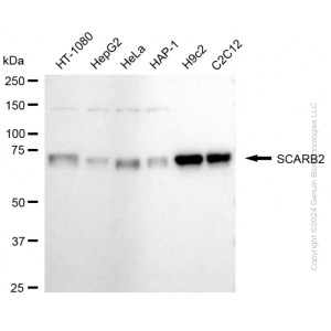 KD-Validated SCARB2 Rabbit mAb (20 μl)