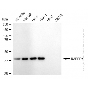 KD-Validated RABEPK Rabbit mAb (20 μl)