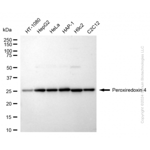 KD-Validated PRDX4 Rabbit mAb (20 μl)