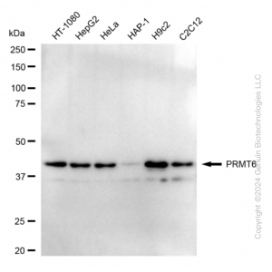KD-Validated PRMT6 Rabbit mAb (20 μl)