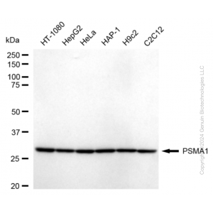 KD-Validated PSMA1 Rabbit mAb (20 μl)