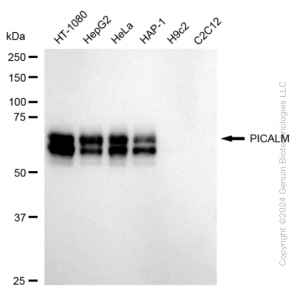 KD-Validated PICALM Rabbit mAb (20 μl)