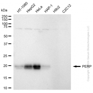 KD-Validated PERP Rabbit mAb (20 μl)