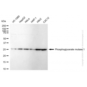 KD-Validated PGAM1 Rabbit mAb (20 μl)