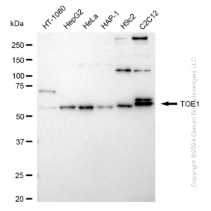 KD-Validated TOE1 Rabbit mAb (20 μl)