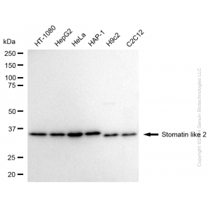 KD-Validated STOML2 Rabbit mAb (20 μl)