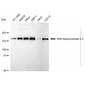 KD-Validated TOP2A Rabbit mAb (20 μl)
