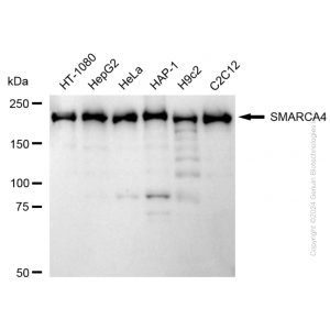 KD-Validated SMARCA4 Rabbit mAb (20 μl)