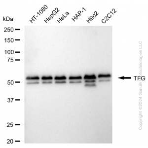 KD-Validated TFG Rabbit mAb (20 μl)