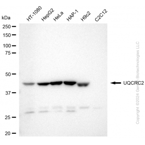 KD-Validated UQCRC2 Rabbit mAb (20 μl)