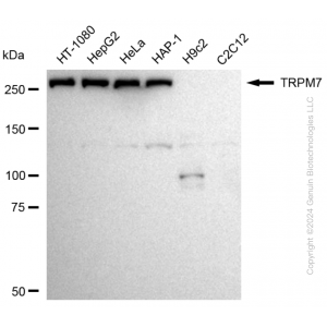 KD-Validated TRPM7 Rabbit mAb (20 μl)